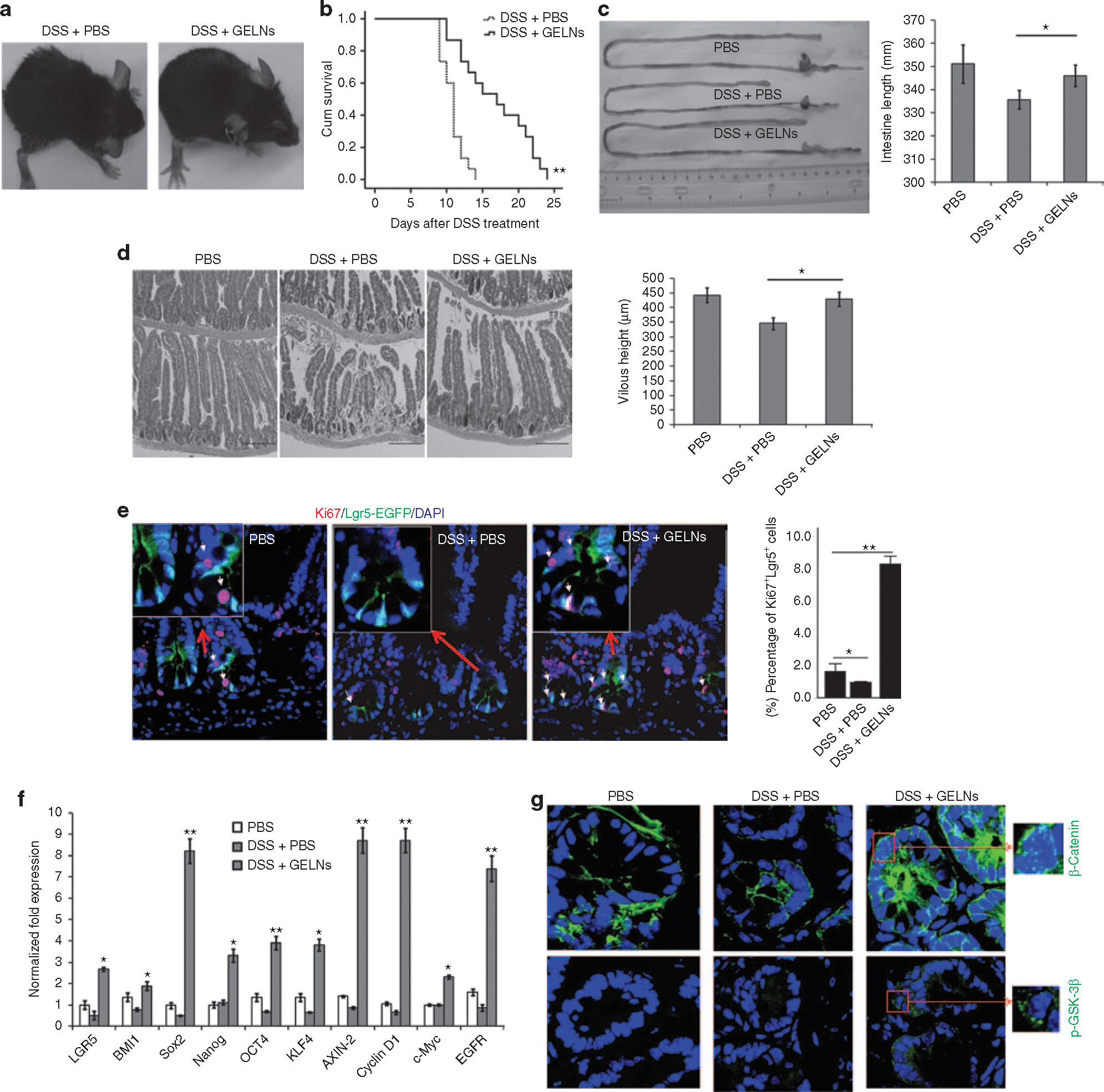 Grape exosome-like nanoparticles improve colitis symptoms by restoring intestinal length, stem cell activity, and Wnt signaling in DSS-treated mice.